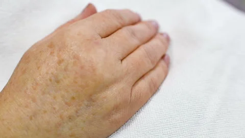 Old women's hands with pigmentation close-up Stock Footage 101435339