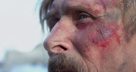 Old, wounded soldier with mustache thinks and looks around with sad eyes Video stock 122294713