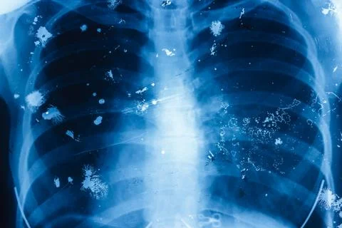 Old x-ray Stock Photos