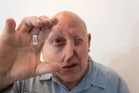 Older man looking through a large lens, distortion, bald, alopecia, chemo Foto stock