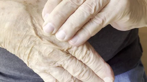 Older man with a sore knuckle Stock Footage 308591556