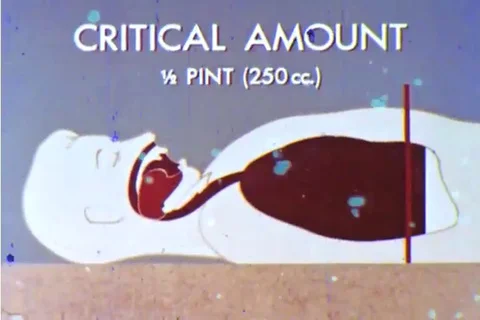 Older methods of dealing with an asphyxiating person are considered obsolete Stock Footage 92634856