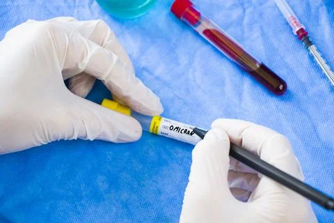 Omicron blood test. Doctor in laboratory with uniform write text on the blood Stock Photos