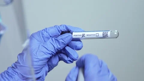 Omicron test positive sars – cov-2 epidemic Stock Footage 167621718