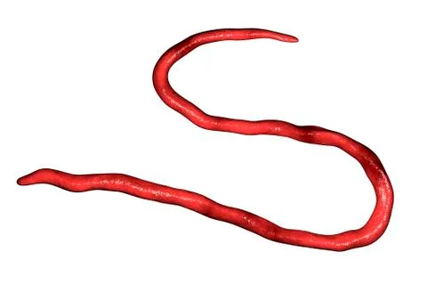 Onchocerca volvulus, a roundworm nematoda that causes onchocerciasis, river b Stock Illustration