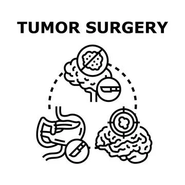 Oncology surgery concept with removing malignant cells Stock Illustration