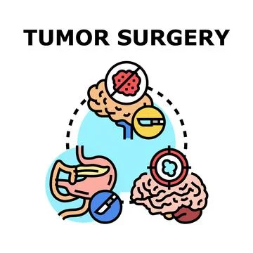 Oncology surgery concept with removing malignant cells Stock Illustration