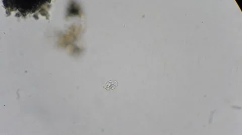 One celled protozoa under microscope, magn 400x Stock-Footage 45597697
