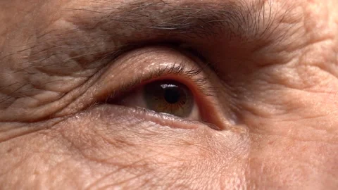 One Eye of the Elderly Man Looks to the Side. Stock Footage 156542533