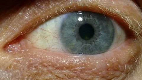   An one  eye of  old man with red capillaries. Macro Stock-Footage 84642844