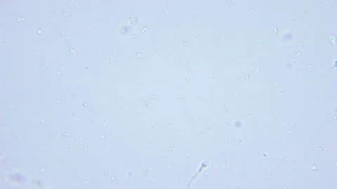 One human sperm under Bright field Microscope 스톡 동영상 80311348