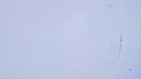 One human sperm under Bright field Microscope 스톡 동영상 80312765