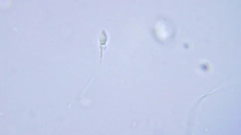 One human sperm under Bright field Microscope Video stock 80358142