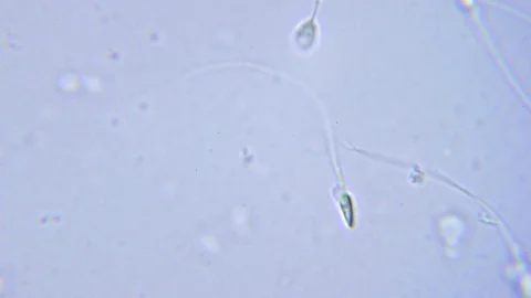 One human sperm under Bright field Microscope 스톡 동영상 80359078