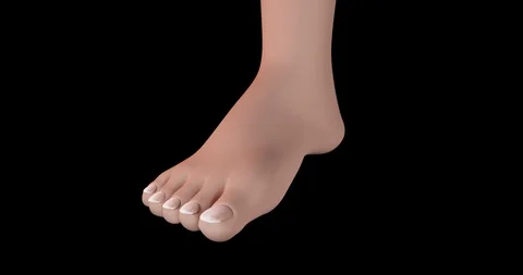 Onychomycosis Condition 動画素材 112662600