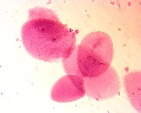 Opalina ranarum - permanent slide plate under high magnification Foto stock