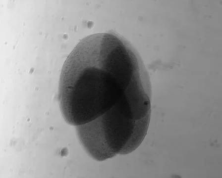 Opalina ranarum - permanent slide plate under high magnification Stock Photos