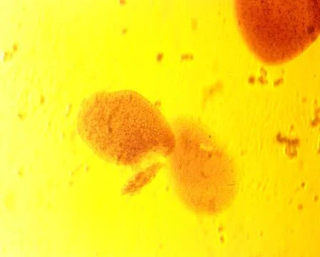 Opalina ranarum - permanent slide plate under high magnification Stock Photos