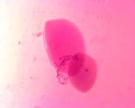 Opalina ranarum - permanent slide plate under high magnification Stock Photos