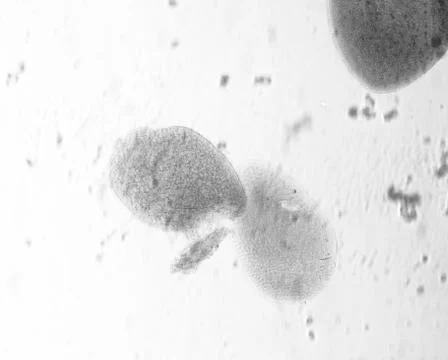 Opalina ranarum - permanent slide plate under high magnification Stock-Fotos