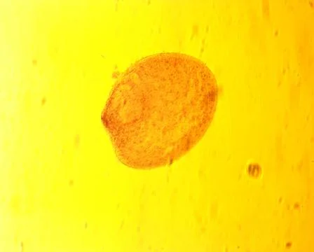 Opalina ranarum - permanent slide plate under high magnification Stock Photos