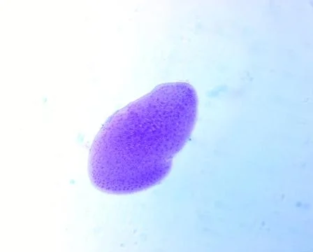 Opalina ranarum - permanent slide plate under high magnification Foto stock