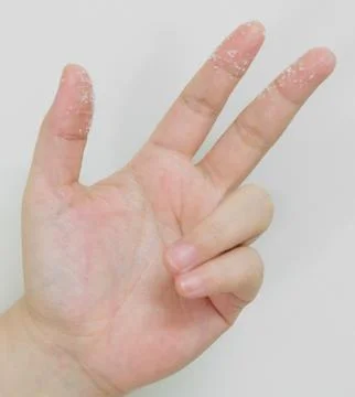 Open Empty Hand Reaches Out with White Sugar on Fingers Stock Photos