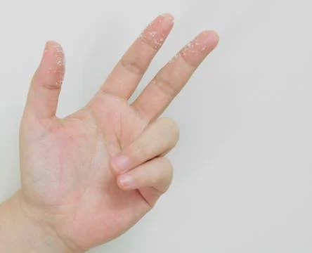 Open Empty Hand Reaches Out with White Sugar Stock Photos