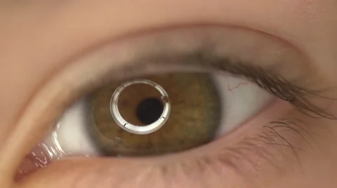 Open Eye Stockbeeldmateriaal 37532708