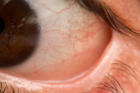 Open eye Foto stock