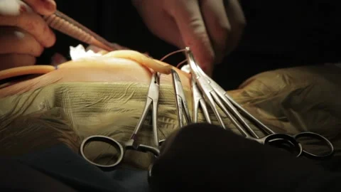 Open Heart Cardiac Surgery with Scissors hanging down Stock Footage 217430203