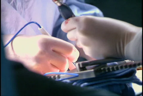 Open Heart Surgery Stockbeeldmateriaal 149168