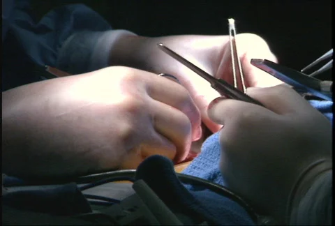 Open Heart Surgery Stock Footage 149170