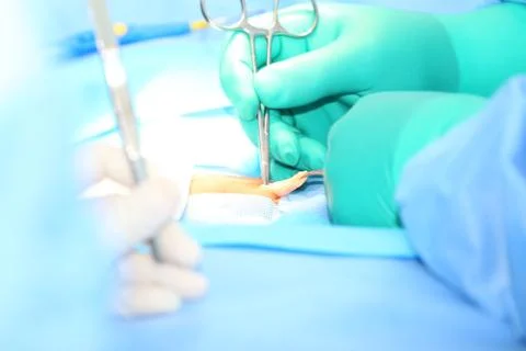 Open hernia surgery Foto stock