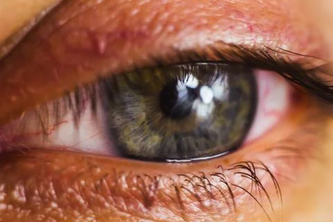 Open human eye with bright red arteries close up. irritation and redness of t Stock Photos