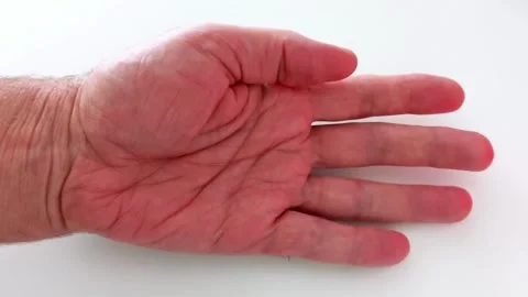 Open Human Hand on White Background- Palm Facing Up, Fingers to Tremble Stock-Footage 318443213
