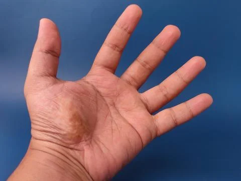 An open human left hand is presented palm up showing palm lines against a s.. Stock Photos