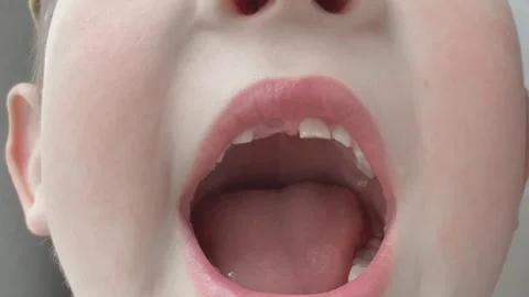 Open mouth of child missing teeth Stock-Footage 320949138