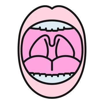 Open mouth displaying tonsils, uvula, and oral cavity Stock Illustration