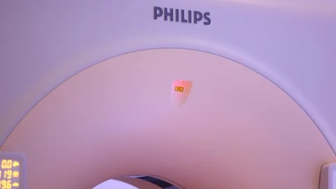 Open MRI X-Ray Machine in Hospital with doctor and cancer patient Stock Footage 123673893