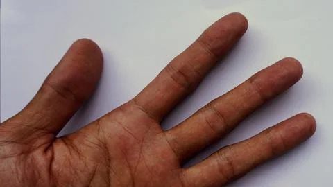 Open palm on a large tree trunk to measure the diameter of the tree trunk Stockfoto's