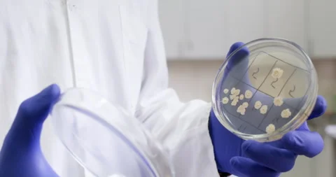 Open Petri dish containing colonies of Escherichia coli. Stock Footage 318524241