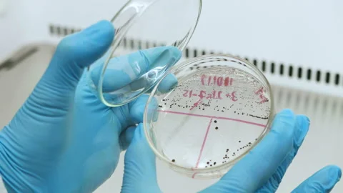 Open PetriDish Stock Footage 104877482