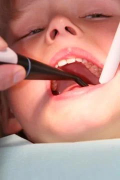 Open wide Stock-Fotos