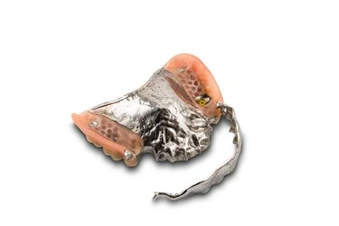 Opened removable swinglock denture isolated on white background. Stock Photos