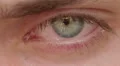 opening and closing of one eye of young man very sad - tears - allergy HD Footage