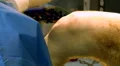 Operating on cadaver knee 03 HD 동영상