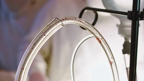 Operating. Laparoscopic surgery. The blood is pumped out. Stock Footage 77397869