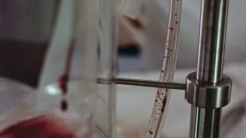 Operating. Laparoscopic surgery. The blood is pumped out. Stock Footage 77397983