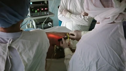 Operating. Laparoscopic surgery. Close-up. Stock Footage 77397992